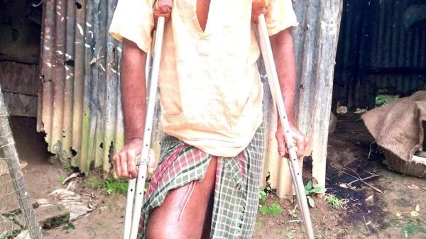 বিকাশ দাস ক্যান্সারে আক্রান্ত,অর্থের অভাবে মৃত্যুর মুখোমুখি,প্রধানমন্ত্রী ও সমাজের বিত্তবানদের প্রতি সহায়তার আবেদন