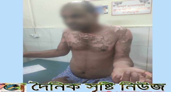গরম পানি ঢেলে স্বামীকে হত্যার চেষ্টা