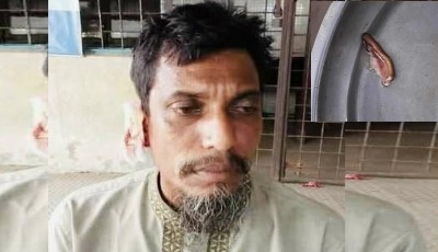 দৌলতপুরে বাকিতে সিগারেট না দেয়ায় কান কামড়ে ছিড়ে দিল দোকানীর