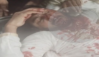 জাতীয় পার্টি কার্যালয়ের সামনে সংঘর্ষে নুরুল হক নুর গুরুতর আহত