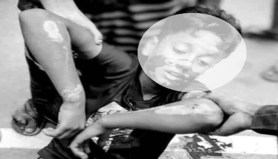 ভূরুঙ্গামারীতে সড়ক দূর্ঘটনায় আহত শিশু হামিমের মৃত্যু