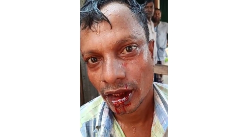 ভূরুঙ্গামারীতে মাদকবিরোধী ক্যাম্পেইনে মাদক কারবারির হামলায় আহত ১